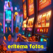 eritema fotos